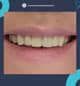 Slider image (10) Dr. Aleksandar Kovacevic - Dental Clinic in Croatia